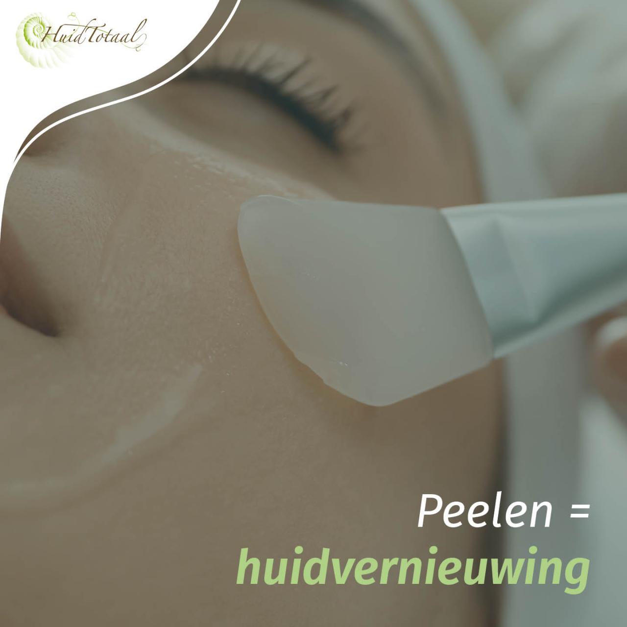 Hoofdafbeelding